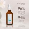 imageMoroccanoil Oily Scalp Treatment 15 Fl Oz