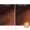 imageMoroccanoil Revitalizing Scalp Tonic Treatment for Thinning Hair
